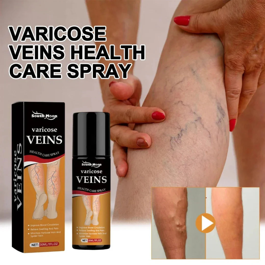 Varicose Veins Treatment Spray(Buy 1 Get 1 Free)