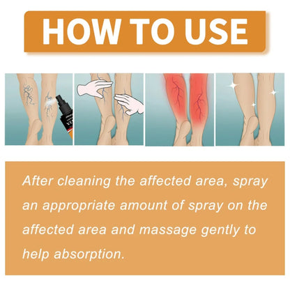 Varicose Veins Treatment Spray(Buy 1 Get 1 Free)
